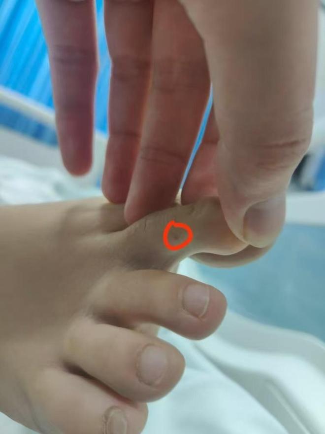 三亚被蛇咬死的美女真冤堂堂三甲医院面对常见蛇伤却毫无办法(图2)